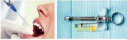 胰島素，牙科麻醉6.png